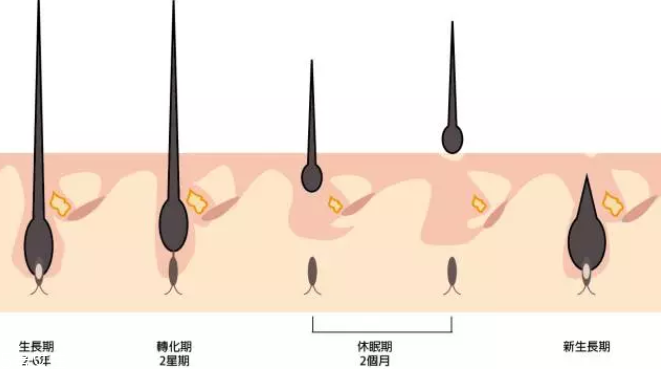 頭發(fā)為什么會(huì)掉？毛囊想休息了