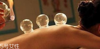 拔火罐引火上身的原因是什么？這4點(diǎn)要注意