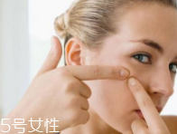 肌膚需要排毒嗎？長痘并不代表排毒
