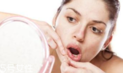 肌膚需要排毒嗎？長痘并不代表排毒