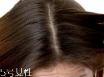 油性頭發(fā)跟什么有關(guān)？離不了這6個原因