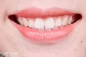 口紅病有哪些癥狀？使用不當(dāng)引發(fā)癌癥