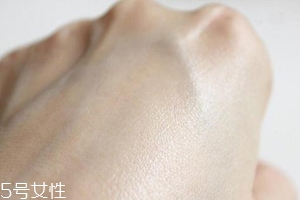 白癜風與身體免疫功能有關系嗎？兩者關系密切