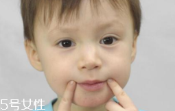 冬天爛嘴角什么原因？有可能營養(yǎng)不良