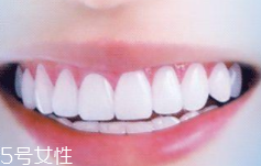 牙線和漱口水是否必要？抑菌護(hù)牙好習(xí)慣