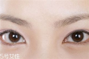 割雙眼皮后怎樣恢復(fù)快？女人不能割雙眼皮的時(shí)期