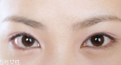 割雙眼皮的術(shù)前準(zhǔn)備有哪些？割雙眼皮的常見做法