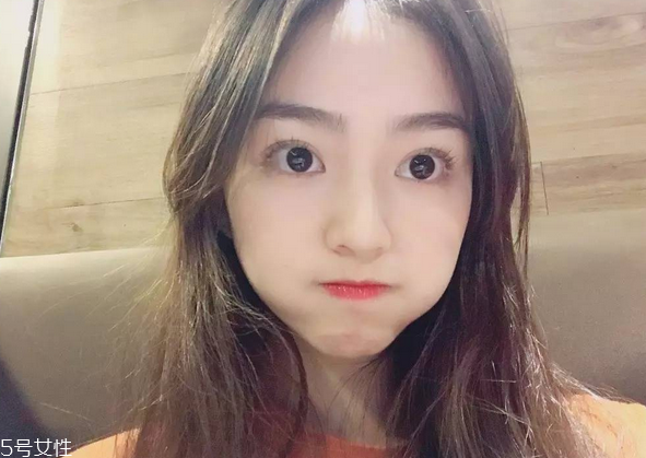 割雙眼皮要注意什么？割雙眼皮充血是正?，F(xiàn)象