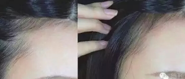 眉粉可以當(dāng)發(fā)際線粉嗎？解救高發(fā)際線的技巧