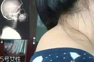 富貴包是什么??？姿態(tài)優(yōu)美少犯病