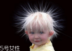 少年白什么原因？焦慮緊張會得病