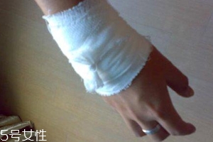 被蜈蚣咬傷后能治愈嗎？科學(xué)家有新發(fā)現(xiàn)