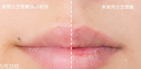 蘭芝唇膜吃進去怎么辦？擁有水嫩嘴唇