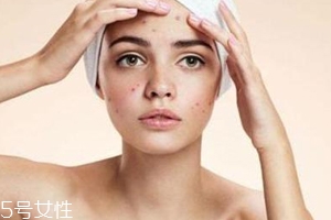 痘痘反復(fù)長是什么原因？基礎(chǔ)護(hù)膚不夠用心