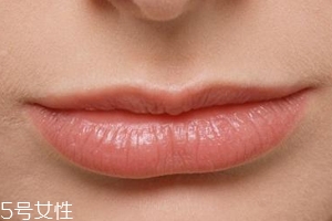 嘴唇干裂是一種病嗎？治療口角炎從改善習(xí)慣入手