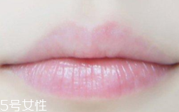 嘴唇干裂是一種病嗎？治療口角炎從改善習(xí)慣入手