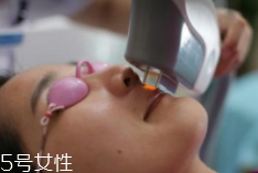 科技脫毛有哪些種類(lèi)？冰點(diǎn)脫毛不毀毛囊