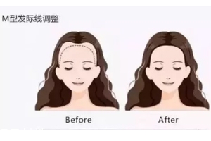 發(fā)際線粉填充和發(fā)際線筆哪個(gè)好？配合使用才最完美