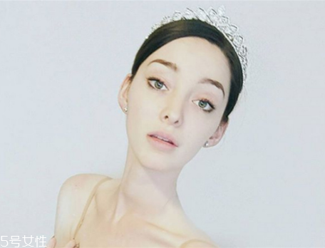 法令紋填充需要幾只玻尿酸？千萬(wàn)不可過(guò)量
