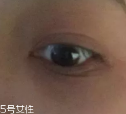 黑眼圈用什么眼霜好？多效護理型眼霜是首選