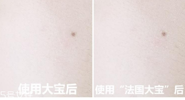 范爺同款法國(guó)大寶Embryolisse和大寶SOD蜜哪個(gè)好用？