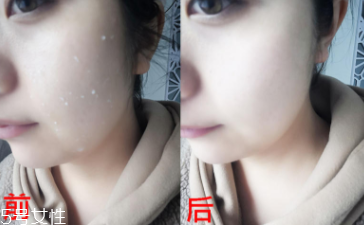 rosette去角質(zhì)凝膠怎么樣？真正的去角質(zhì)產(chǎn)品