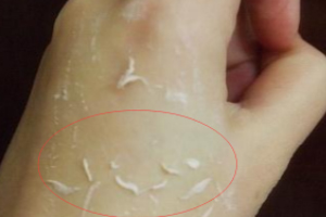 去角質(zhì)凝露多久用一次？皮厚一周一次