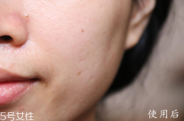 悅木之源和伊麗莎白雅頓哪個(gè)好？兩款精華大比拼