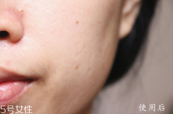 悅木之源和伊麗莎白雅頓哪個(gè)好？兩款精華大比拼