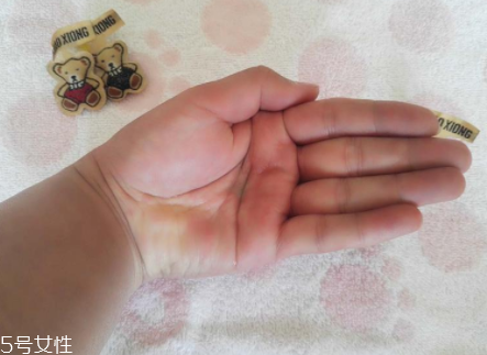 柳屋生發(fā)水有用嗎？一個月后長出新發(fā)