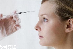川字紋可以打玻尿酸嗎？不是最佳選擇