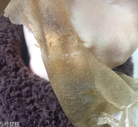 雪花秀撕拉面膜怎么撕出黑頭？這么做才能去黑頭