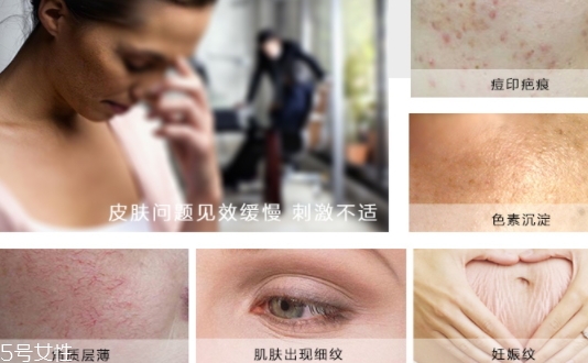 德國(guó)krauterhof蝸牛精華膏效果怎么樣？
