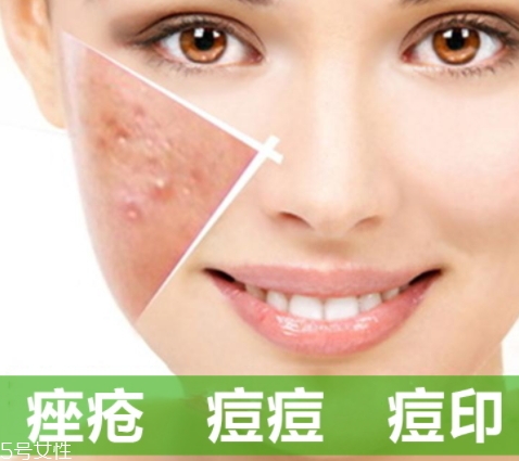 a酸怎么用？a酸怎么建立耐受？