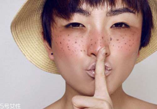 祛斑反彈是什么原因？一定沒(méi)注意這4點(diǎn)