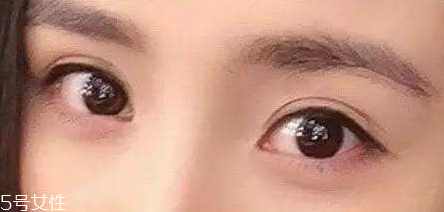 葉黃素能治療夜盲癥嗎？看什么類型的