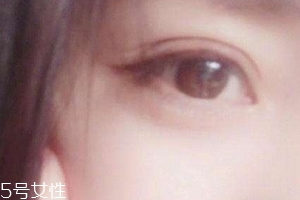 葉黃素一天吃多少毫克？按說明服用