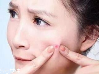 臉頰老長痘痘怎么辦 4個小技巧穩(wěn)贏 臉頰老長痘痘怎么辦 4個小技巧穩(wěn)贏