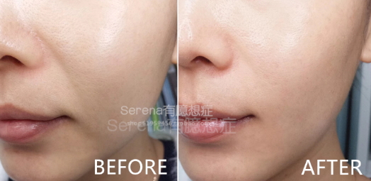dermawand逆齡射頻注氧棒怎么用？
