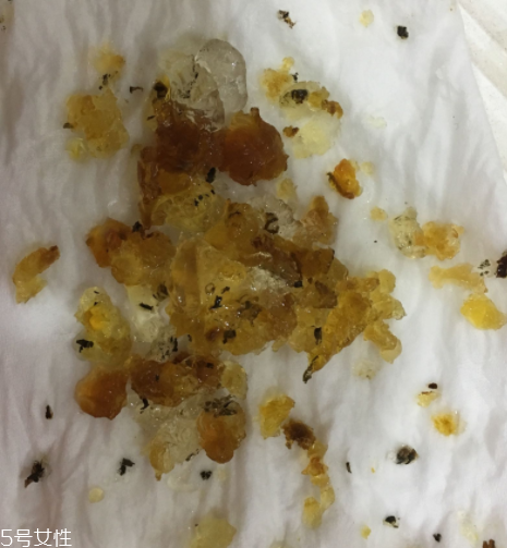 桃膠能和雞蛋一起吃嗎？桃膠配雞蛋可以嗎？