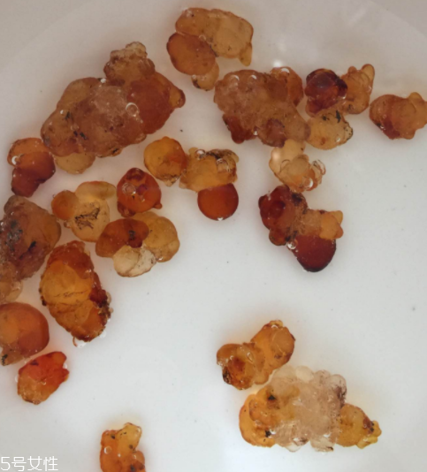 桃膠能治胃病嗎？胃病吃桃膠好嗎？