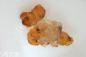 桃膠可以用開水泡嗎？用開水泡桃膠好嗎？