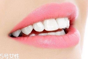 超聲波潔牙牙齒會變白嗎？超聲波潔牙心得