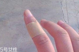 創(chuàng)可貼可以消腫嗎？創(chuàng)可貼有消腫功效嗎？