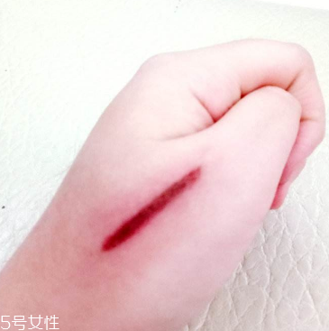 創(chuàng)可貼和肉連著怎么辦？創(chuàng)可貼連著肉怎么處理？