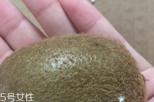 綠心獼猴桃含葉酸嗎？綠心獼猴桃里面有葉酸嗎？