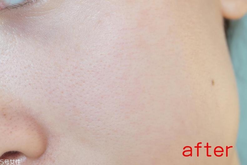 radha beauty vc精華白天能用嗎？敏感肌能用嗎？