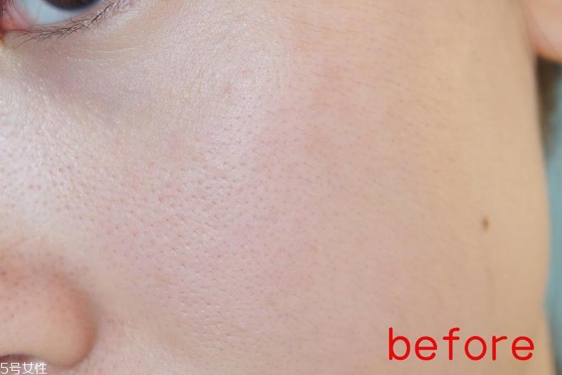 radha beauty vc精華白天能用嗎？敏感肌能用嗎？