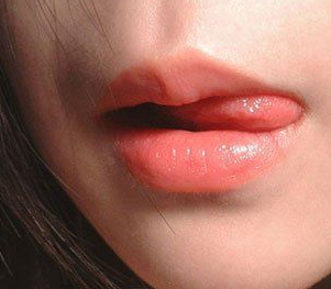 兔唇修復(fù)要多少錢(qián)？兔唇修復(fù)風(fēng)險(xiǎn)大嗎