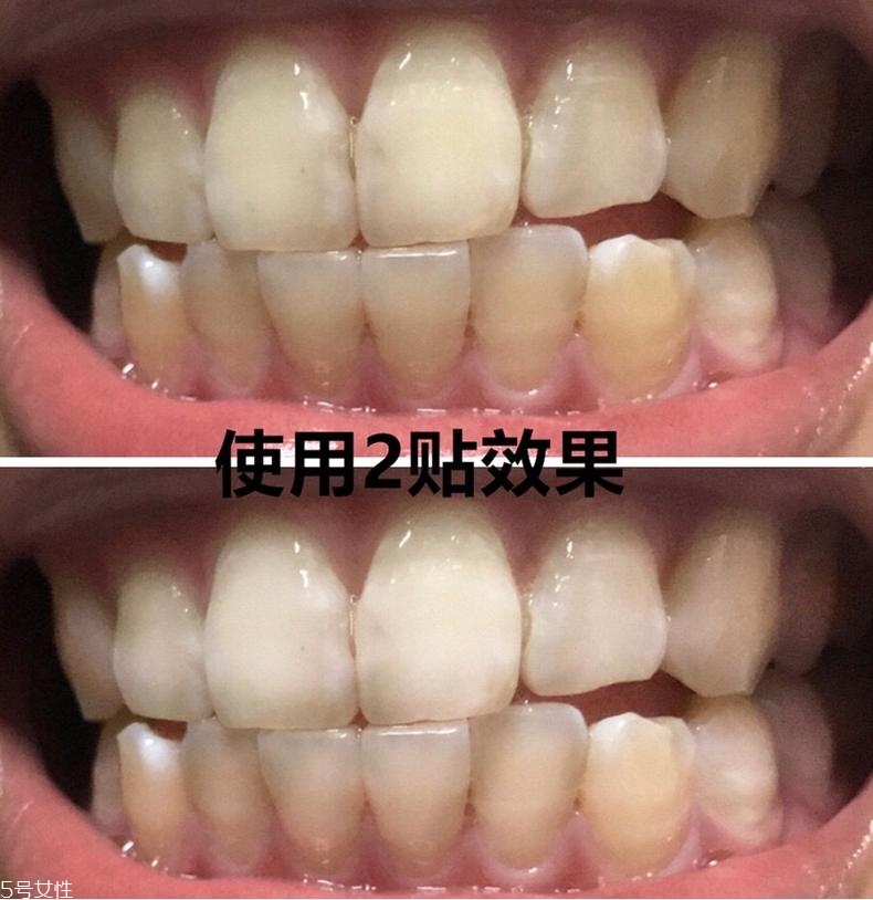 佳潔士美白牙貼貼多久有效？佳潔士美白牙貼使用感受